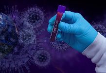 Korona virus: 1. septembra registrovano 50 zaraženih u opštini Bečej